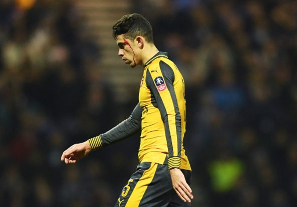 1-hit wonders: 20 players who scored just once for Arsenal 20 Gabriel v Preston
