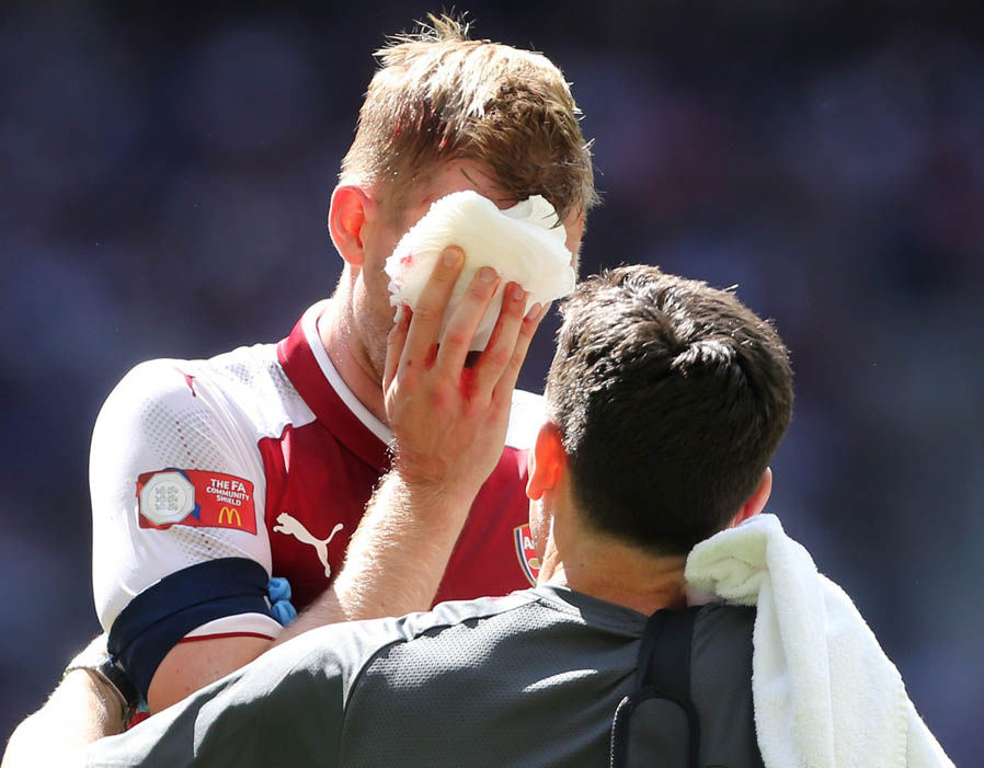 Mertesacker head injury
