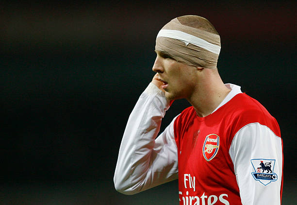 LONDON - JANUARY 31: Philippe Senderos of Arsenal wears a bandage following a head injury during the Carling Cup Semi Final Second Leg match betwee...