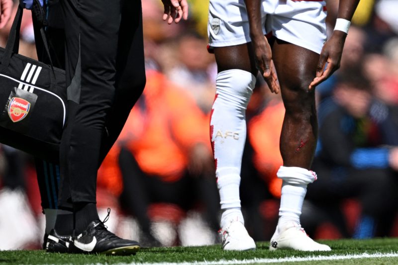 VAR fails Arsenal again: Saka left bloody after appalling challenge 2 Arsenal's English midfielder #07 Bukayo Saka (R) waits to come back into play after clashing with Bournemouth's English midfielder #04 Lewis Cook during the English Premier League football match between Arsenal and Bournemouth at the Emirates Stadium, in London, on May 4, 2024. (Photo by JUSTIN TALLIS/AFP via Getty Images)