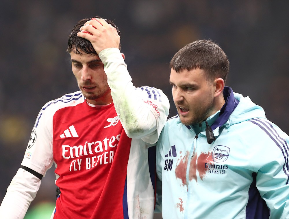 MILAN, ITALY: Kai Havertz of Arsenal reacts after suffering a head injury and subsequently being substituted off during the UEFA Champions League 2...