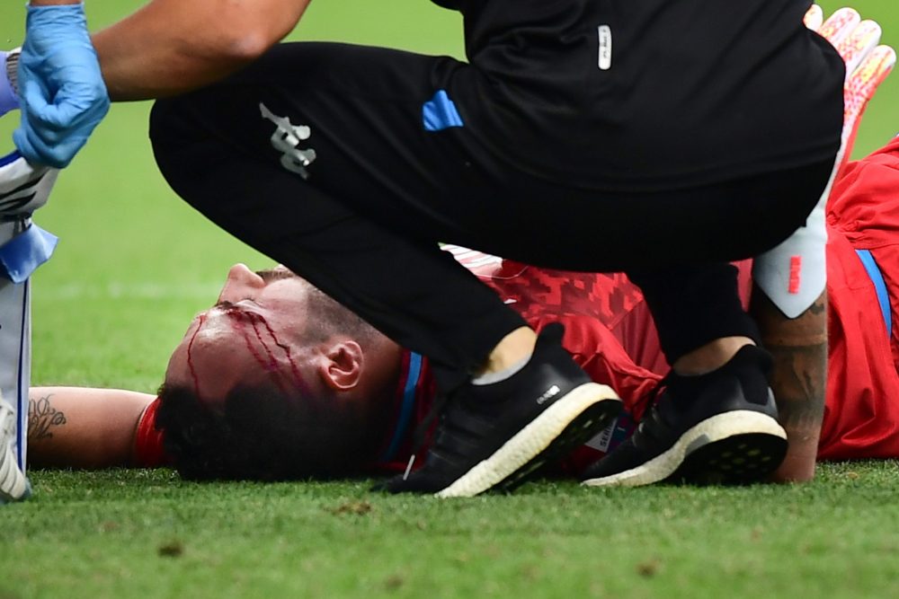 A staff medic tends to Napoli's Colombian goalkeeper David Ospina after he collided with Atalanta's Italian defender Mattia Caldara during the Italian Serie A football match Atalanta vs Napoli played on July 2, 2020 behind closed doors at the Atleti Azzurri d'Italia stadium in Bergamo, as the country eases its lockdown aimed at curbing the spread of the COVID-19 infection, caused by the novel coronavirus. (Photo by Miguel MEDINA / AFP) 