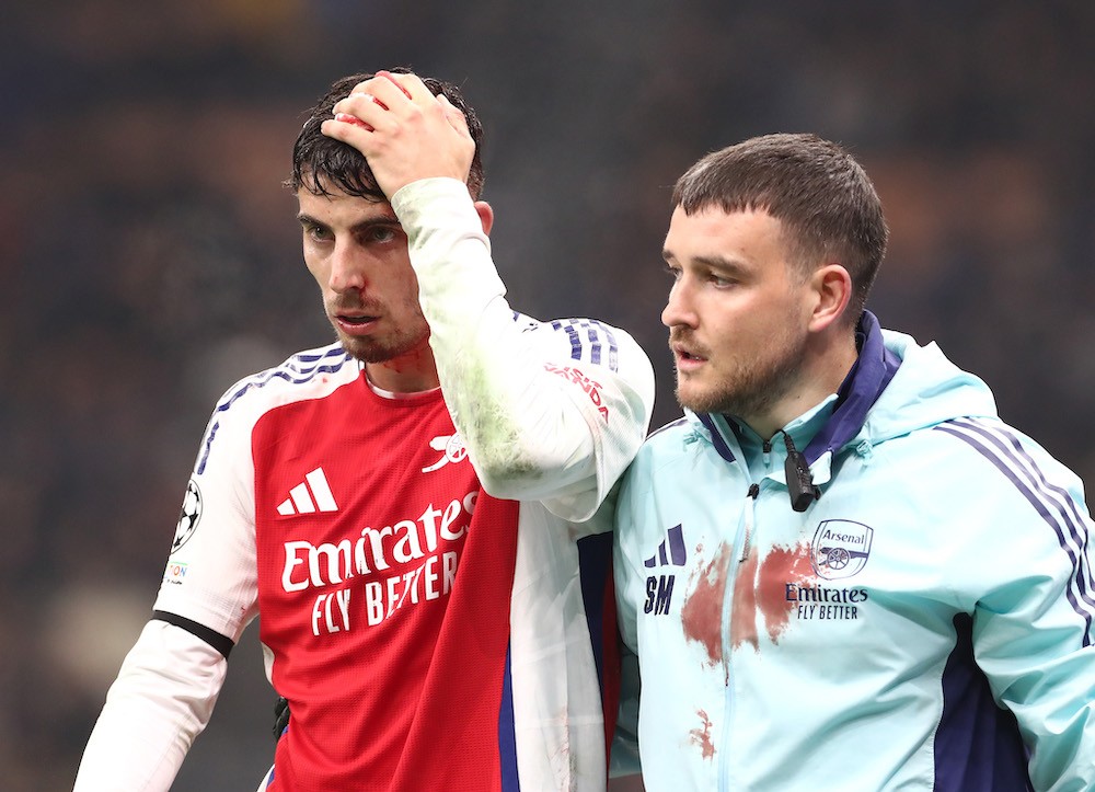 MILAN, ITALY: Kai Havertz of Arsenal reacts after suffering a head injury and subsequently being substituted off during the UEFA Champions League 2024/25 League Phase MD4 match between FC Internazionale Milano and Arsenal FC at Stadio San Siro on November 06, 2024. (Photo by Marco Luzzani/Getty Images)